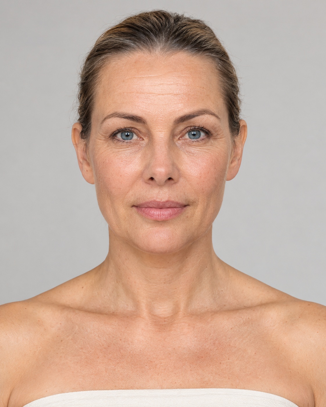 Behandelzones voor HIFU in het gezicht